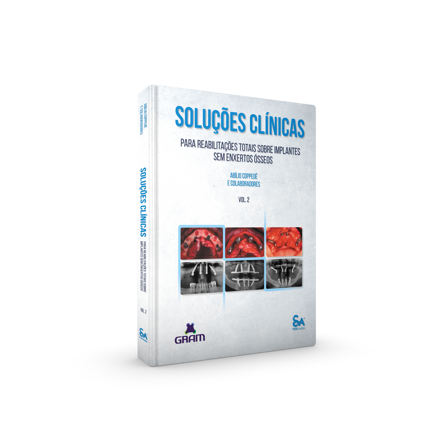 Clinical Solutions for Total Rehabilitation on Implants without Bone Grafts (Vol. 2) - Abílio Coppedê & Collaborators